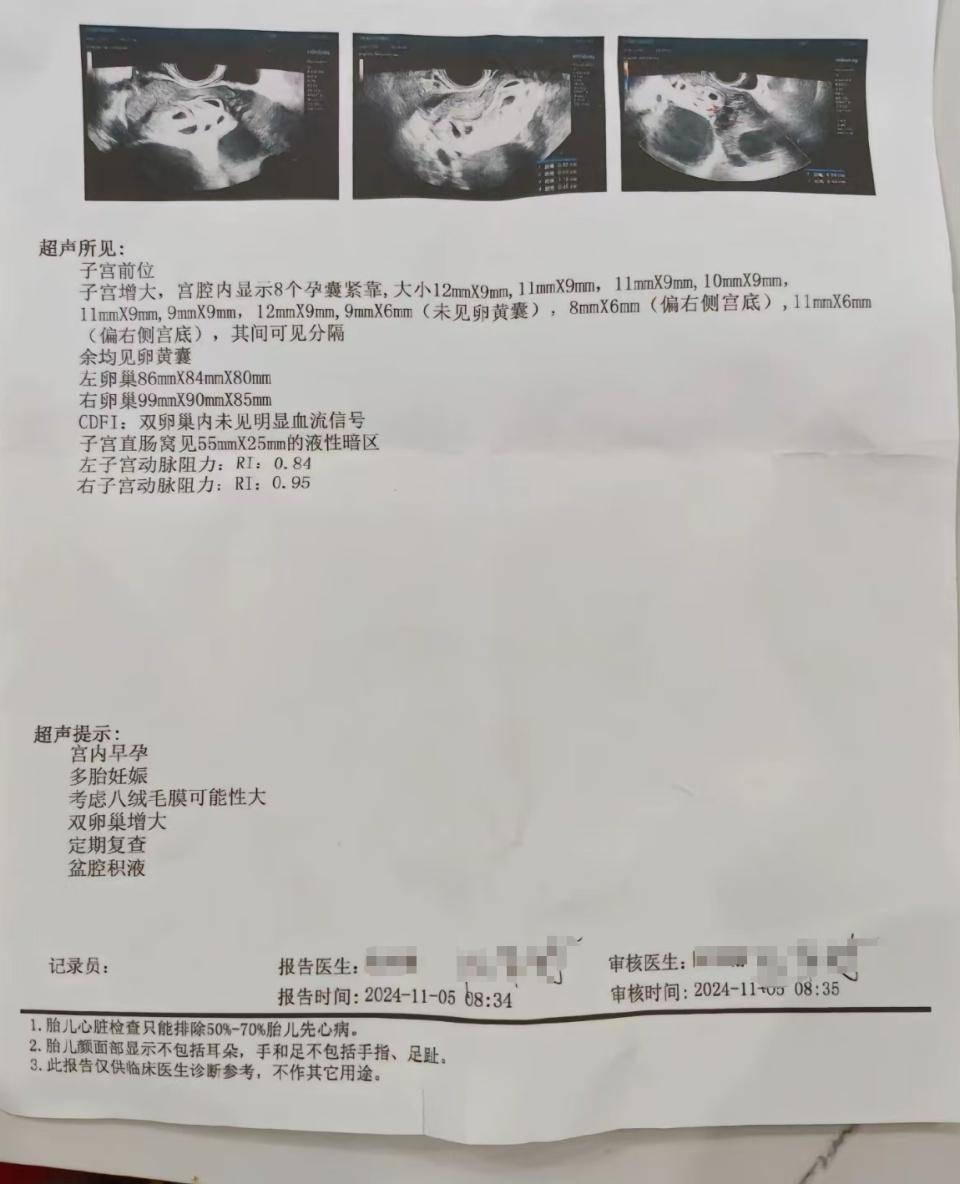 怀上9胞胎女子今日进行减胎手术:分两次进行<strong></p>
<p>货币直接交易</strong>,第一次减去四个胚胎,第二次减去三个