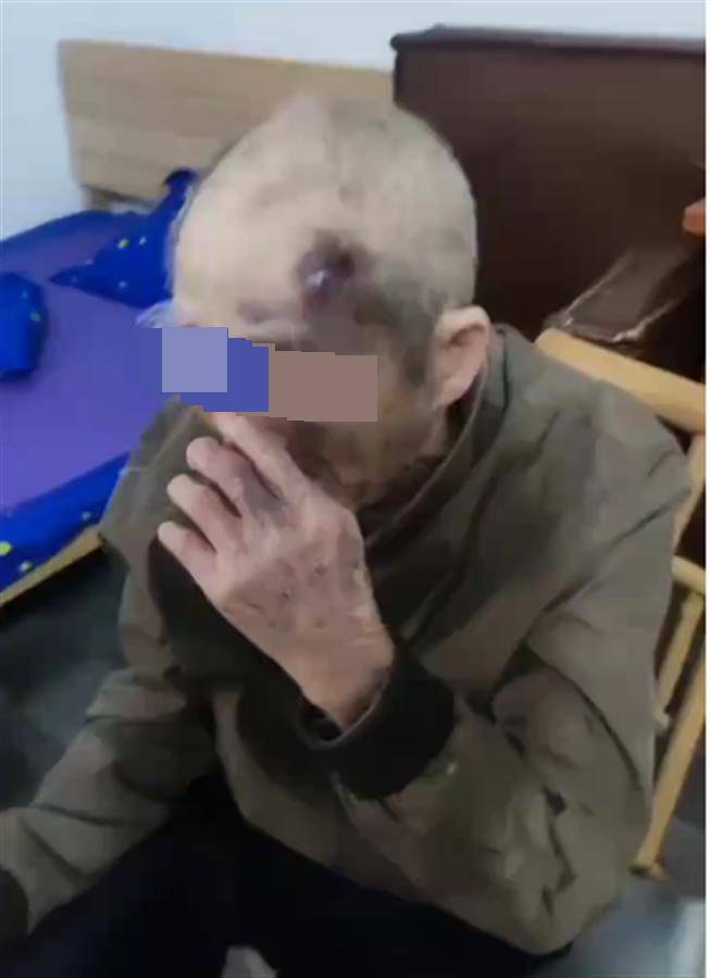 广东阳江一养老院护工长期虐待九旬老人？民政局已介入<strong></p>
<p>基于软件</strong>，警方：正了解情况