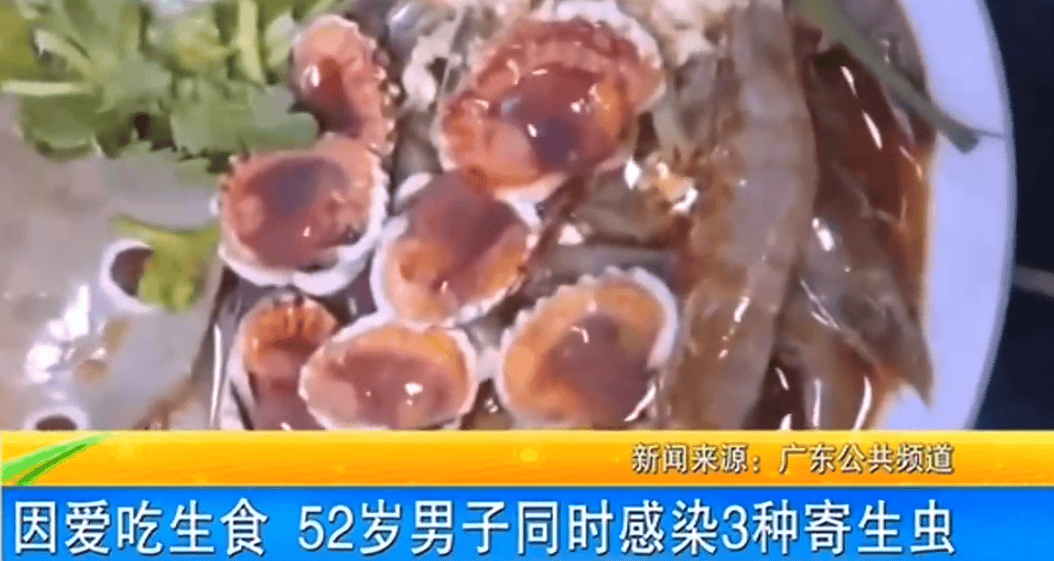 女子体内排出10米长绦虫<strong></p>
<p>债券交易流程</strong>！原是两年前旅游时吃了这种食物