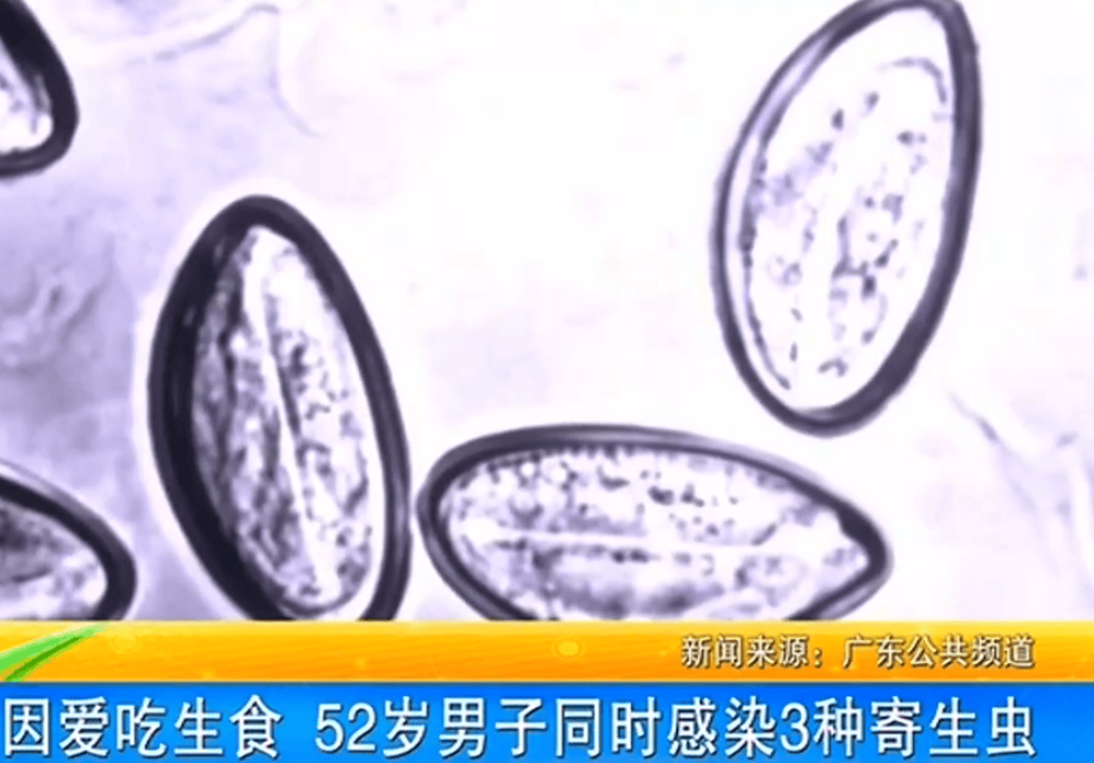 女子体内排出10米长绦虫<strong></p>
<p>债券交易流程</strong>！原是两年前旅游时吃了这种食物