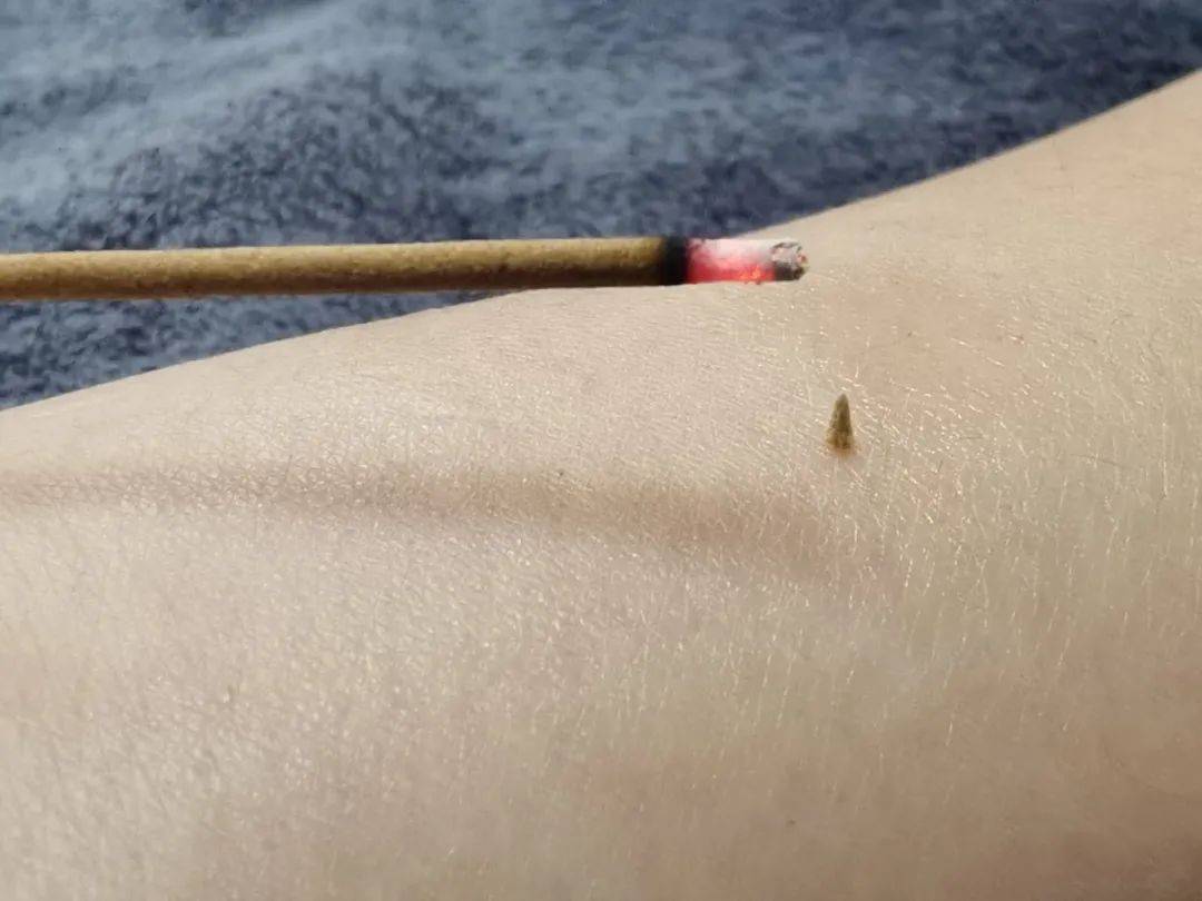 醒来“天塌了”<strong></p>
<p>门罗币软件</strong>！深圳一女子眼睛闭不上、嘴巴漏水！这些错误很多人会犯