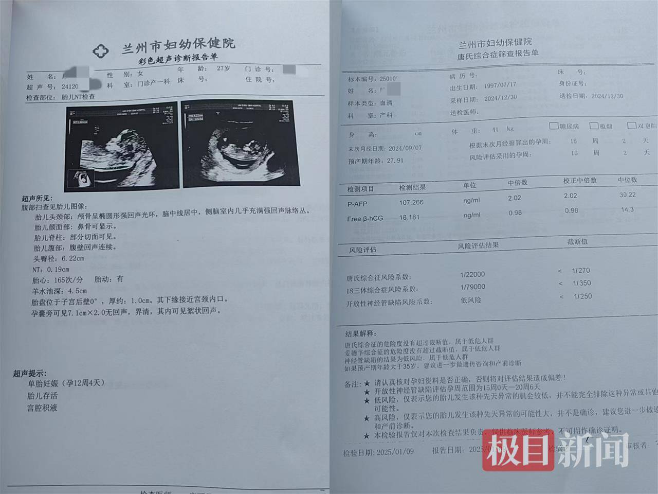 二胎出生查出先天性病症或落下残疾<strong></p>
<p>四五软件</strong>,残疾父母称医院产检漏检、未尽告知义务,医院及医调委回应