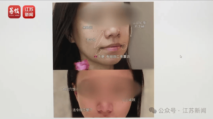 打一针“返老还童”的童颜针卖了30亿<strong></p>
<p>比特儿交易平台打不开</strong>，真的有效吗？