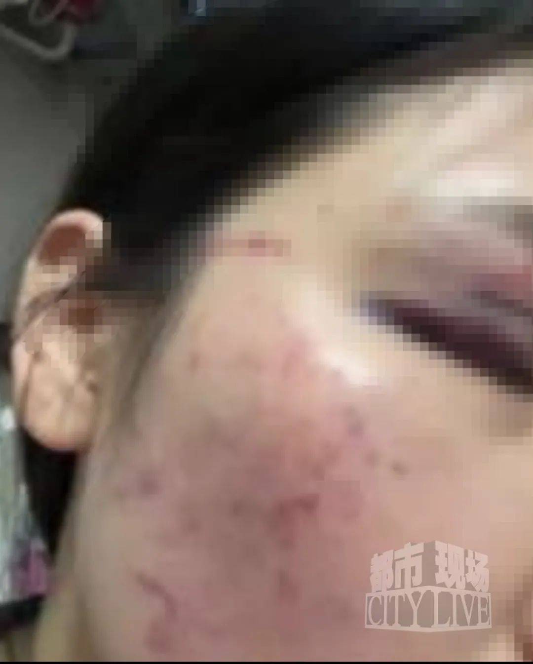 湖南衡阳29岁女子疑被男友施暴后从25楼跳下身亡 男友徐某此前还刺激说：“你放心<strong></p>
<p>比特派新钱包</strong>，她不会去死的”