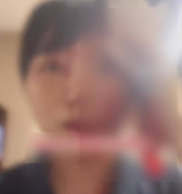 缝了20多针!女子称被不知名男同事砸头毁容<strong></p>
<p>比特派怎样使用教程</strong>,警方介入