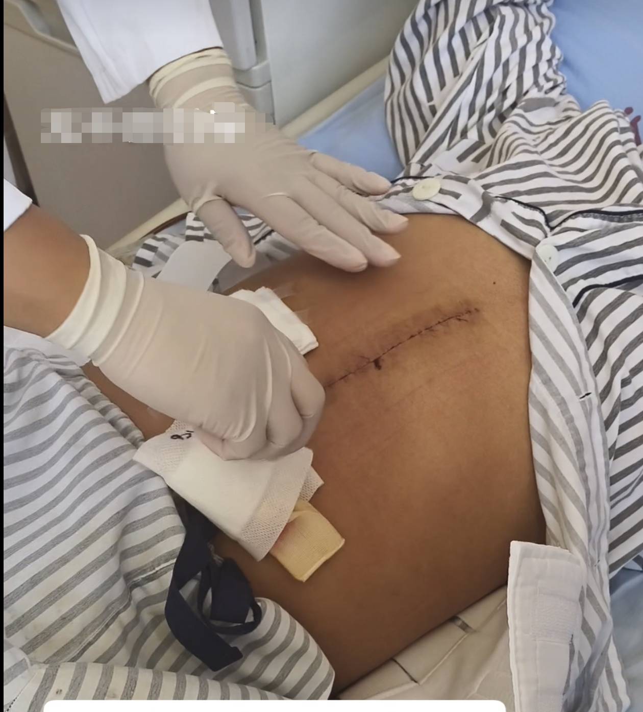 奶奶在哭<strong></p>
<p>币安</strong>，宝宝在笑！40天女婴重病，00后父亲割肝救女，术后这一幕让网友泪奔