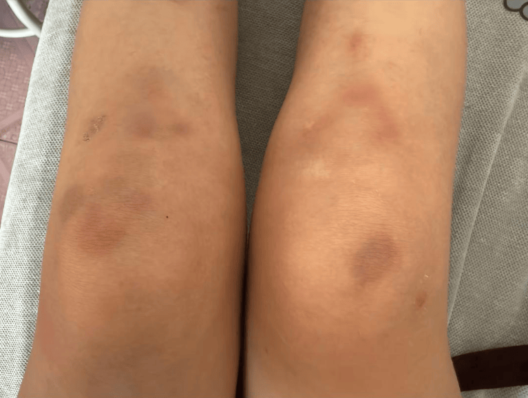 女子自称因工资问题被老板锁办公室里打 警方:双方已到派出所<strong></p>
<p>币安老板</strong>,是否打人还在调查