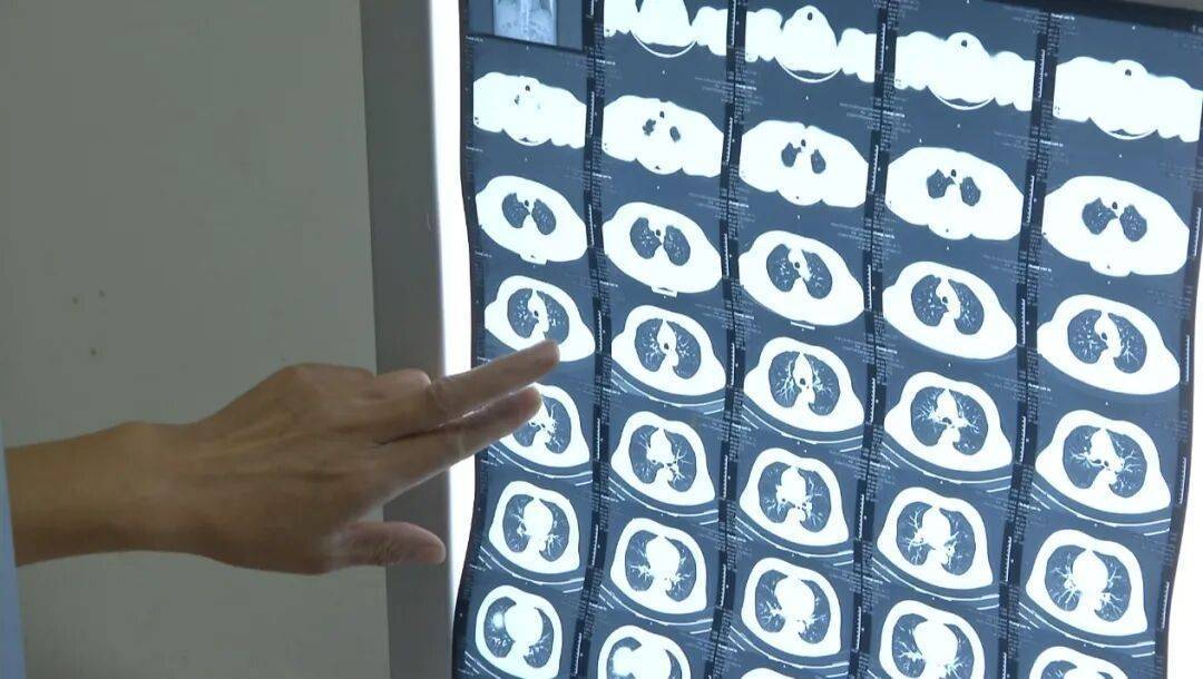 许多患者没有症状<strong></p>
<p>币安注册</strong>，发病就猝死！警惕这种心脏疾病