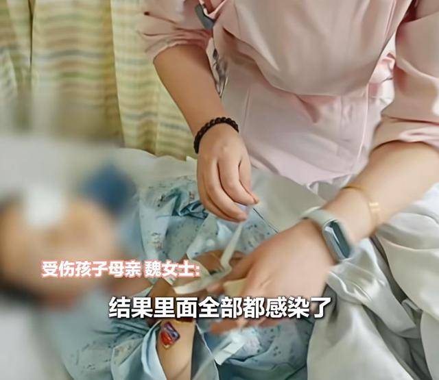 江西一5岁男孩在幼儿园被戳伤致左眼失明<strong></p>
<p>币安官网下载</strong>,家长称老师用猪油涂抹试图消肿