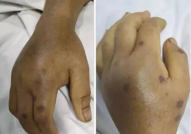 深圳一市民突遭马蜂围袭！已进入高发期<strong></p>
<p>币安官网入口</strong>，千万别招惹！