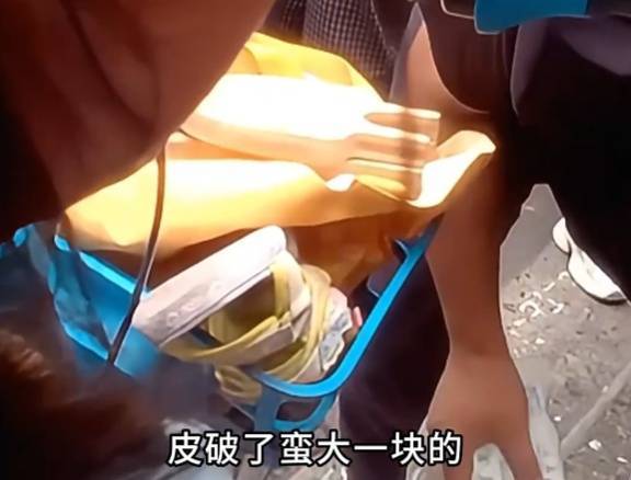 看着都疼<strong></p>
<p>币安网站</strong>!上海街头一男子突然求助:10岁女儿被死死卡住!这个行为太危险→