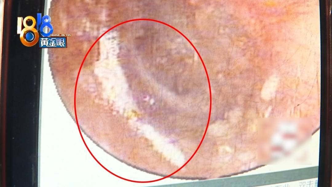 杭州姑娘痒了一整夜<strong></p>
<p>BLUR币</strong>，检查结果让她崩溃……浴场回应索赔：凭什么要两千？