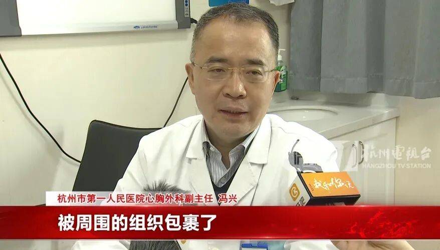 17岁小伙参军体检发现胸腔内有根5cm缝衣针<strong></p>
<p>偿债基金系数</strong>，父母回忆或是1岁时扎入，取出时已锈迹斑斑